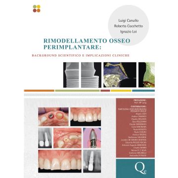 Rimodellamento osseo perimplantare - Background scientifico e implicazioni cliniche