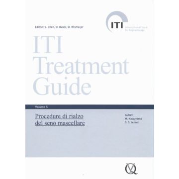 ITI Treatment Guide 5 - Procedure di rialzo del seno mascellare
