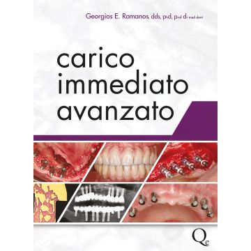 Carico immediato Avanzato