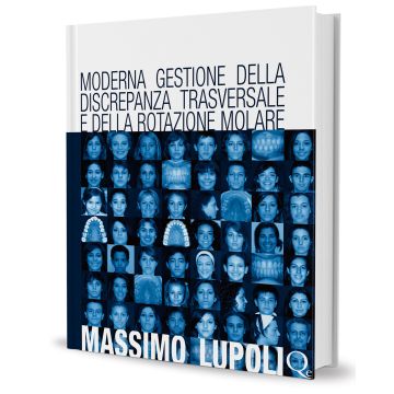 Moderna gestione della discrepanza trasversale e della rotazione molare
