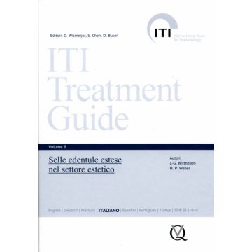ITI Treatment Guide 6 - Selle edentule estese nel settore estetico