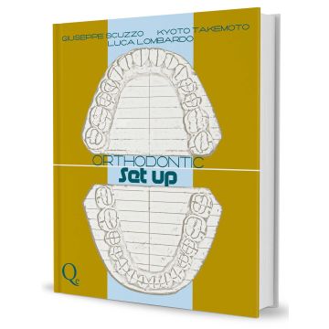 Orthodontic Set Up (Ortodonzia - Italiano)