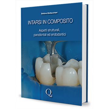 Intarsi in composito. Aspetti strutturali, parodontali ed endodontici