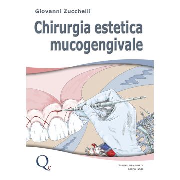 Chirurgia Estetica Mucogengivale