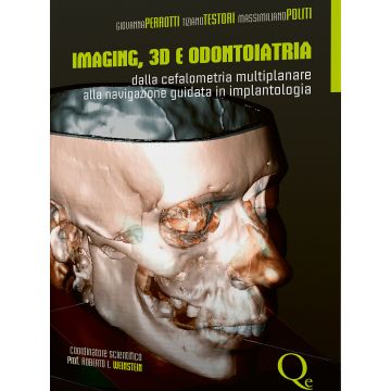 Imaging 3D e Odontoiatria. Dalla Cefalometria Multiplanare alla Navigazione Guidata in implantologia