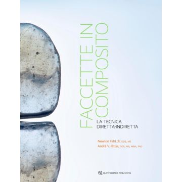 Faccette in composito. La tecnica diretta-indiretta