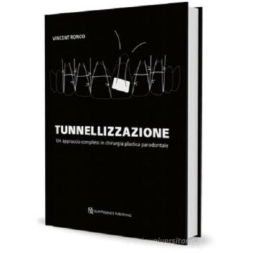 Tunnellizzazione. Un approccio completo in chirurgia plastica parodontale
