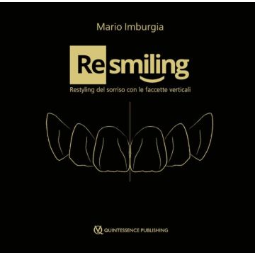 (Re)smiling Restyling del sorriso con le faccette verticali