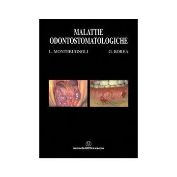 Malattie Odontostomatologiche