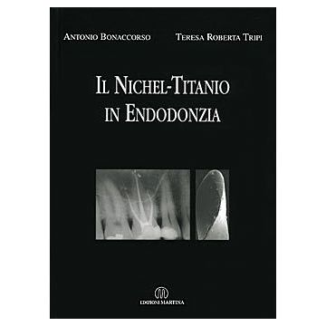 Il Nichel-Titanio in Endodonzia