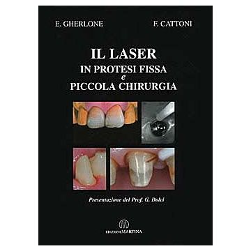 Il Laser in Protesi fissa e piccola Chirurgia