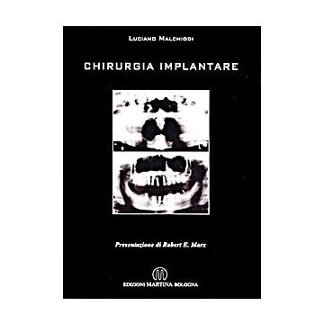 Chirurgia Implantare