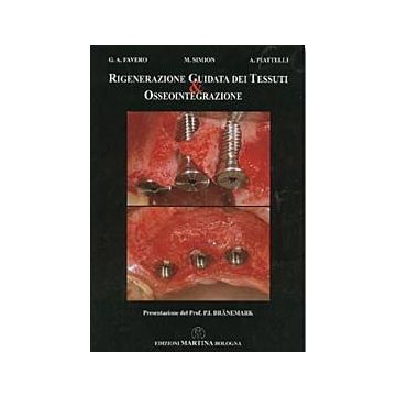 Rigenerazione guidata dei tessuti e osseointegrazione