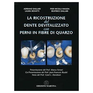 La ricostruzione del dente devitalizzato con perni in fibre di quarzo