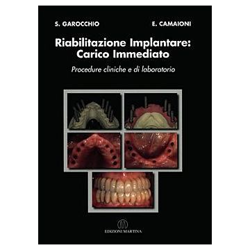 Riabilitazione Implantare: Carico Immediato - Procedure cliniche e di laboratorio