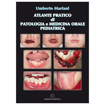 Atlante pratico di Patologia e Medicina Orale Pediatrica