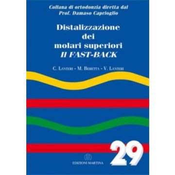 Distalizzazione dei molari superiori. Il fast-back Vol. 29