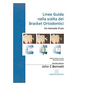 Linee Guida nella scelta dei Bracket Ortodontici - Un manuale d’uso