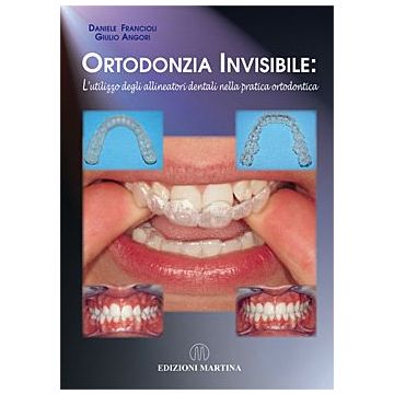 Ortodonzia Invisibile: L’utilizzo degli allineatori dentali nella pratica ortodontica