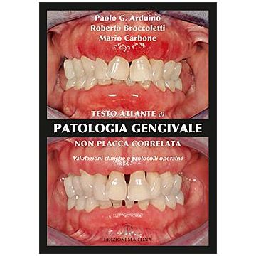 Testo Atlante di Patologia Gengivale non Placca Correlata - Valutazioni Cliniche e Protocolli Operativi