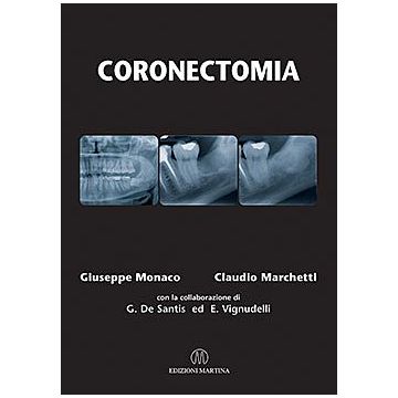 Coronectomia