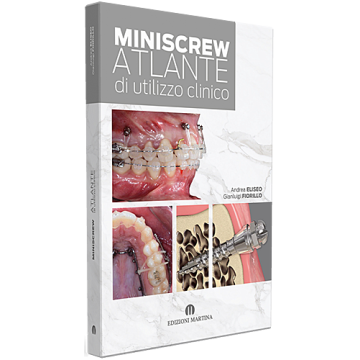 MINISCREW Atlante di utilizzo clinico. Atlante sulle miniscrew ortodontiche. L’innovazione nell'ancoraggio ortodontico dalle tecniche di inserimento alla risoluzione di casi complessi