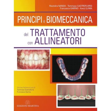 Principi e Biomeccanica del trattamento con allineatori