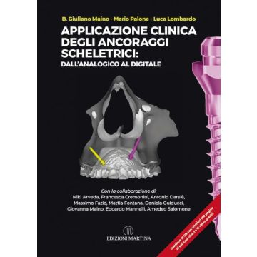 Applicazione clinica degli Ancoraggi Scheletrici: dall’analogico al digitale