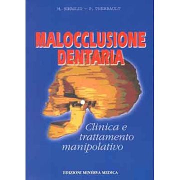 Malocclusione dentaria
