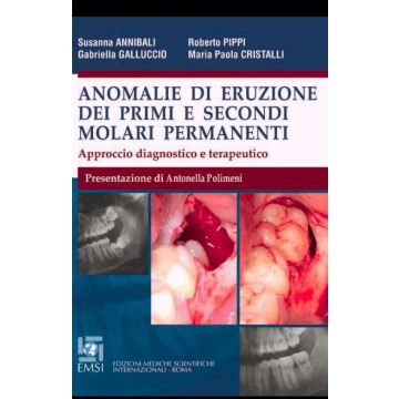 Anomalie di eruzione dei primi e secondi molari permanenti - Approccio diagnostico e terapeutico