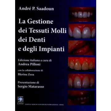 La Gestione dei Tessuti Molli dei Denti e degli Impianti