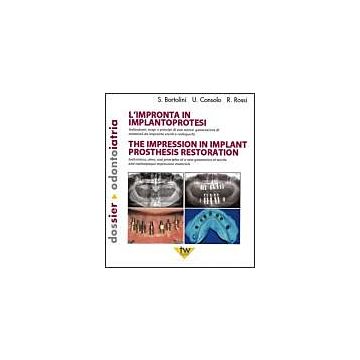 L'Impronta in Implantoprotesi. Indicazioni, scopi e principi di una nuova generazione di materiali da impronta sterili e radiopachi