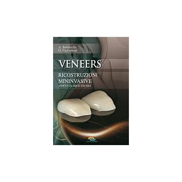 Veneers ricostruzioni mini-invasive. Aspetti clinico tecnici (Le faccette)