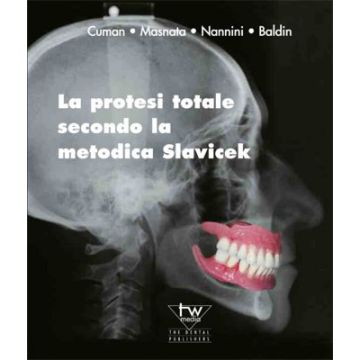 La protesi totale secondo la metodica Slavicek
