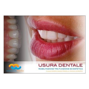 Usura Dentale. Riabilitazione tra funzione ed estetica