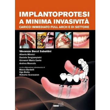 Implantoprotesi a minima invasività. Carico immediato Full Arch e di settore