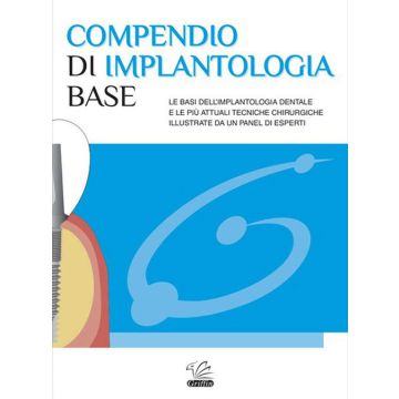 Compendio di Implantologia Base. Le basi dell'implantologia dentale e le più attuali tecniche chirurgiche illustrate