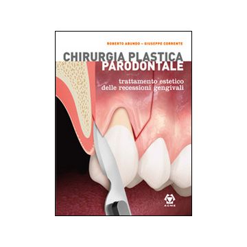 Chirurgia Plastica Parodontale. Trattamento Estetico delle recessioni gengivali + Appendici e cofanetto