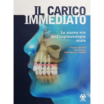 Il carico immediato - La nuova era dell' implantologia orale
