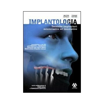 Implantologia. Tecniche implantari mininvasive e innovative