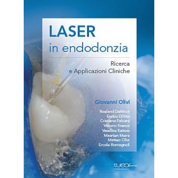 Laser in Endodonzia. Ricerca e Applicazioni Cliniche