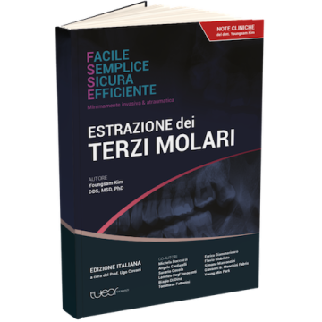Estrazione dei terzi molari