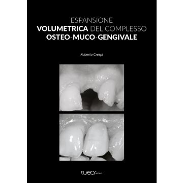 Espansione volumetrica del complesso Osteo-Muco-Gengivale