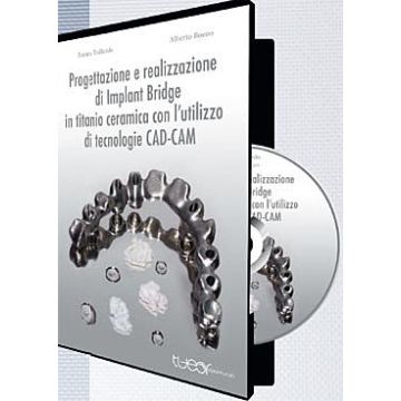 Progettazione e Realizzazione di Implant Bridge in Titanio Ceramica con l'utilizzo di Tecnologie CAD-CAM - DVD ROM