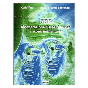 GBR Rigenerazione Ossea Guidata a scopo Implantare