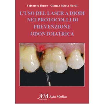 L'uso del laser a Diodi nei protoccolli di prevenzione odontiatrica