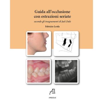Guida all'occlusione con estrazioni seriate secondo gli insegnamenti di Jack Dale