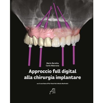 Approccio full digital alla chirurgia implantare