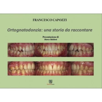Ortognatodonzia: una storia da raccontare - Capozzi Francesco