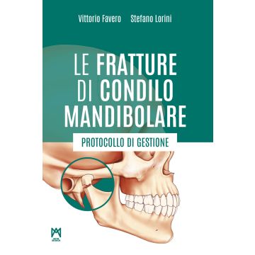 Le fratture di condilo mandibolare. Protocollo di gestione